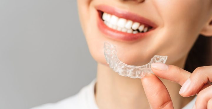 A young woman does a home teeth whitening procedure. Whitening tray with gel.